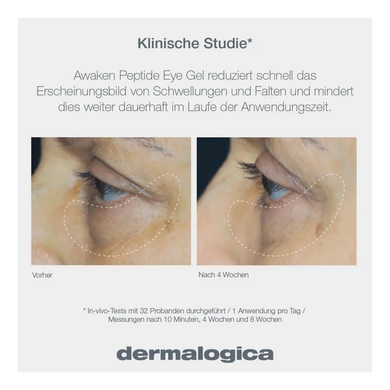 Awaken Peptide Eye Gel fra Dermalogica i 15 ml – produktbillede 3 af 4