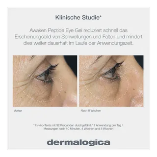 Awaken Peptide Eye Gel fra Dermalogica i 15 ml – produktbillede 1 af 4
