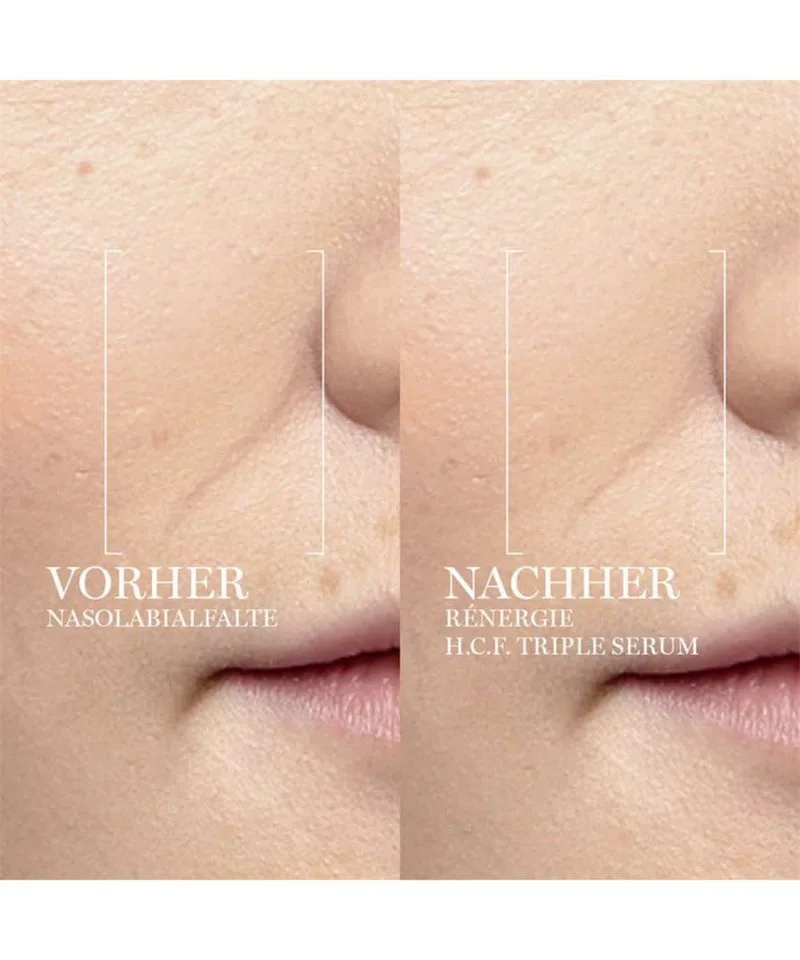 Rénergie H.C.F. Triple Serum Serum de Lancôme en 50 ml – photo du produit 4 sur 4