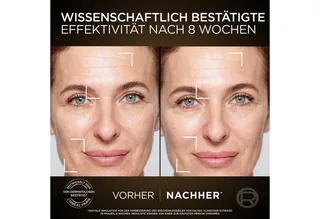 Gesichtspflege-Set L'Oréal Paris Age Perfect Zell-Renaissance Tag & Nacht Set Set, 2-tlg. von L'Oréal Paris in Weiß – Produktfoto 4 von 5