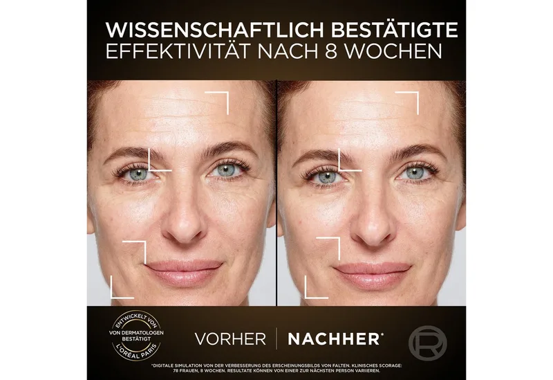Gesichtspflege-Set L'Oréal Paris Age Perfect Zell-Renaissance Tag & Nacht Set Set, 2-tlg. von L'Oréal Paris in Weiß – Produktfoto 4 von 5