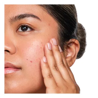 Direct Acids Salicylic Acid 2% Solution Face Fluid fra The Ordinary i 30 ml – produktbillede 4 af 5