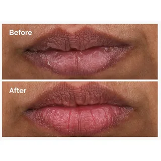 PHA 5% Exfoliating Lip Serum von The Ordinary – Produktfoto 4 von 4